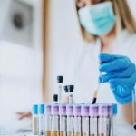 На Львівщині зафіксовано 52 нових випадки захворюв...