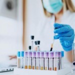 На Львівщині зафіксували 33 нових випадки захворюв...