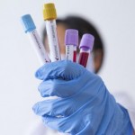 На Львівщині зафіксували 12 нових випадків захворю...