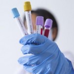 На Львівщині зафіксували 30 нових випадків захворю...