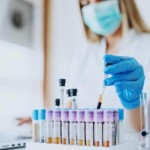 На Львівщині зафіксували 20 нових випадків захворю...