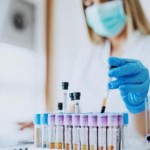 На Львівщині зафіксували 18 нових випадків захворю...
