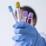 На Львівщині зафіксували 8 нових випадків захворюв...