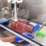 На Львівщині зафіксували 51 новий випадок захворюв...
