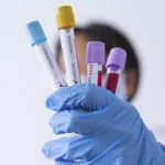 На Львівщині зафіксували 48 нових випадків захворю...