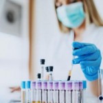 На Львівщині зафіксували 9 нових випадків захворюв...