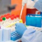 На Львівщині зафіксували 61 новий випадок захворюв...