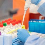 На Львівщині зафіксували 49 нових випадків захворю...