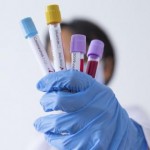 На Львівщині зафіксували 25 нових випадків захворю...
