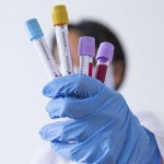 На Львівщині зафіксували 183 нових випадки захворю...