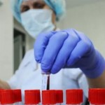 Епідемічна ситуація на Львівщині погіршується: мед...