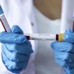 Україна вийшла із топ 10 країн з найбільшою захвор...